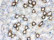 IHC testing of FFPE mouse kidney with CYP1B1 antibody. HIER: Boil the paraffin sections in pH 6, 10mM citrate buffer for 20 minutes and allow to cool prior to staining.