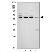 Western blot testing of 1) human MCF7, 2) human PC-3, 3) rat heart and 4) mouse heart tissue lysate with CYP1B1 antibody. Predicted molecular weight ~61 kDa.