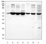 Western blot testing of 1) human Jurkat, 2) human K562, 3) human HEL, 4) human A431, 5) human 293T, 6) human SiHa and 7) mouse HEPA1/6 cell lysate with MICB antibody. Predicted molecular weight ~43 kDa but may be observed at higher molecular weights due to glycosylation.