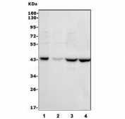Western blot testing of human 1) Raji, 2) SCG-7901, 3) SW620 and 4) Jurkat cell lysate with MICA antibody. Predicted molecular weight: ~43 kDa but may be observed at 38-62 kDa depending on truncation and glycosylation level.
