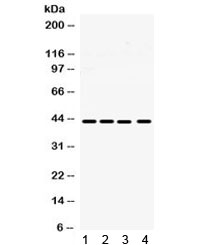 Western blot testing of human 1) SW620, 2) A549, 3) MCF-7 and 4) HeLa cell lysate with MICA antibody. Predicted molecular weight: ~43 kDa but may be observed at 38-62 kDa depending on truncation and glycosylation level.~