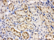 IHC testing of FFPE mouse kidney with CRY2 antibody. HIER: Boil the paraffin sections in pH 6, 10mM citrate buffer for 20 minutes and allow to cool prior to staining.