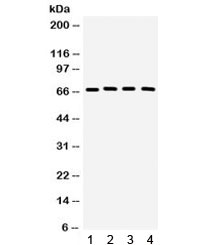 Western blot testing of 1) rat testis, 2) rat brain, 3) mouse brain, 4) human 22RV1 lysate with CRY2 antibody. Expected/observed molecular weight ~67 kDa.~