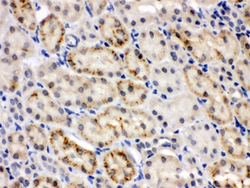 IHC testing of FFPE mouse kidney with CRY2 antibody. HIER: Boil the paraffin sections in pH