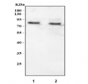 Western blot testing of 1) rat liver and 2) mouse liver tissue lysate with Srb1 antibody. Predicted molecular weight: 57-82 kDa depending on level of glycosylation.