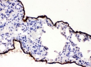 IHC testing of FFPE mouse lung with Mesothelin antibody. HIER: Boil the paraffin sections in pH 6, 10mM citrate buffer for 20 minutes and allow to cool prior to staining.
