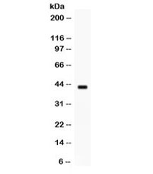 Western blot testing of human MCF7 cell lysate with Sp5 antibody. Expected/observed molecular weight ~42 kDa.~