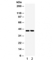 Western blot testing of 1) rat heart and 2) human SKOV lysate with SFRP4 antibody. Routinely observed molecular weight: 40-55 kDa depending on glycosylation level.