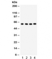 Western blot testing of 1) human placenta, 2) HepG2, 3) 293 and 4) HeLa lysate with HRPT2 antibody. Predicted/observed molecular weight ~61 kDa.