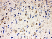 IHC testing of FFPE rat brain with ULK3 antibody. HIER: Boil the paraffin sections in pH 6, 10mM citrate buffer for 20 minutes and allow to cool prior to staining.