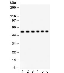 Western blot testing of 1) rat brain, 2) rat testis, 3) mouse brain, 4) human placenta, 5) 22RV1, and 6) SMMC lysate with ULK3 antibody. Predicted/observed molecular weight ~53 kDa.