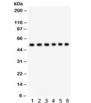 Western blot testing of 1) rat brain, 2) rat testis, 3) mouse brain, and human 4) placenta, 5) 22RV1, and 6) SMMC lysate with ULK3 antibody. Predicted/observed molecular weight ~53 kDa.