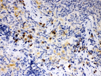 IHC testing of FFPE rat spleen with ATG14L antibody. HIER: Boil the paraffin sections in pH 6, 10mM citrate buffer for 20 minutes and allow to cool prior to staining.