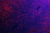 Immunofluorescent staining of FFPE rat spleen tissue with ATG14L antibody (red) and DAPI nuclear stain (blue). HIER: steam section in pH8 EDTA buffer for 20 min.