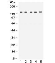 Western blot testing of human 1) HeLa, 2) 22RV1, 3) SW620, 4) A549 and 6) A431 cell lysate with TRPM8 antibody. Expected/observed molecular weight ~128 kDa.