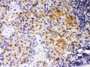 IHC testing of FFPE rat spleen with SKAP55 antibody. HIER: Boil the paraffin sections in pH 6, 10mM citrate buffer for 20 minutes and allow to cool prior to staining.