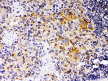 IHC testing of FFPE rat spleen with SKAP55 antibody. HIER: Boil the paraffin sections in p