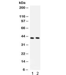 Western blot testing of human 1) A549 and 2) HeLa cell lysate with STING antibody. Predicted molecular weight ~42/35 kDa.~
