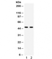 Western blot testing of 1) rat brain and 2) rat kidney lysate with PTOV1 antibody. Predicted/expected molecular weight ~47 kDa.