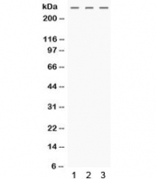 Western blot testing of human 1) HeLa, 2) MCF7 and 3) SW620 cell lysate with MGA antibody. Expected molecular weight ~331 kDa.