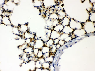 IHC testing of FFPE mouse lung with SFTPA1/2 antibody. HIER: Boil the paraffin sections in pH 6, 10mM citrate buffer for 20 minutes and allow to cool prior to staining.