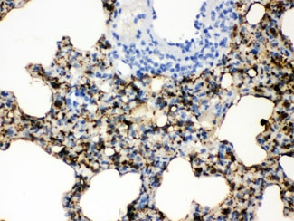 IHC testing of FFPE rat lung with SFTPA1/2 antibody. HIER: Boil the paraffin sections in pH 6, 10mM citrate buffer for 20 minutes and allow to cool prior to staining.