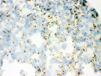 IHC testing of frozen mouse lung with SFTPA1/2 antibody.
