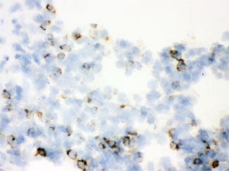 IHC testing of frozen rat lung with SFTPA1/2 antibody.