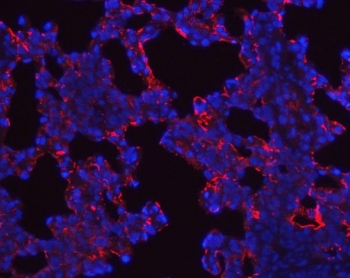 Immunofluorescent staining of FFPE rat lung tissue with SFTPA1/2 antibody (red) and DAPI nuclear stain (blue). HIER: steam section in pH6 citrate buffer for 20 min.