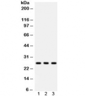 Western blot testing of 1) rat lung, 2) mouse lung, 3) A549 lysate with SFTPA1/2 antibody. Predicted molecular weight: ~26 kDa but may be observed at higher molecular weights due to glycosylation.