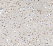 IHC testing of FFPE rat brain with SSH3BP1 antibody. HIER: Boil the paraffin sections in pH8 EDTA buffer for 20 minutes and allow to cool prior to staining.