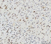 IHC testing of FFPE mouse brain with SSH3BP1 antibody. HIER: Boil the paraffin sections in pH8 EDTA buffer for 20 minutes and allow to cool prior to staining.