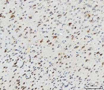 IHC testing of FFPE mouse brain with SSH3BP1 antibody. HIER: Boil the paraffin sections in pH8 EDTA buffer for 20 minutes and allow to cool prior to staining.