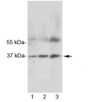 Western blot testing of 1) rat heart, 2) rat skeletal muscle and 3) human MCF7 lysate with MRGX1 antibody. Expected molecular weight ~37 kDa.