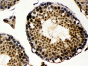 IHC testing of FFPE rat testis with UBE1C antibody. HIER: Boil the paraffin sections in pH 6, 10mM citrate buffer for 20 minutes and allow to cool prior to staining.