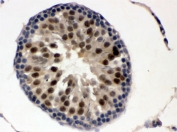 IHC testing of FFPE mouse testis with UBE1C antibody. HIER: Boil the paraffin sections in pH 6, 10mM citrate buffer for 20 minutes and allow to cool prior to staining.