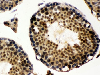 IHC testing of FFPE rat testis with UBE1C antibody. HIER: Boil the paraffin sections in pH 6, 10mM citrate buffer for 20 minutes and allow to cool prior to staining.