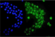 Immunofluorescent staining of FFPE human A431 cells with UBE1C antibody (green) and DAPI nuclear stain (blue). HIER: steam section in pH6 citrate buffer for 20 min.