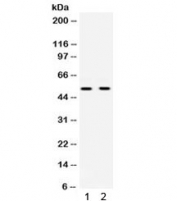 Western blot testing of 1) rat brain and 2) human HeLa lysate with UBE1C antibody. Expected molecular weight ~52 kDa.