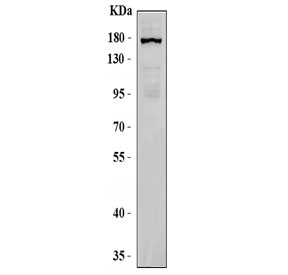 Western blot testing of human HeLa cell lysate with TRPM4 antibody. Predicted molecular weight: 116/134/119 kDa,(TRPM4a/b/c).