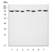 Western blot testing of 1) human HeLa, 2) human HepG2, 3) human PANC-1, 4) rat liver, 5) rat RH35, 6) mouse liver and 7) mouse NIH 3T3 cell lysate with ALIX antibody. Expected/observed molecular weight ~96 kDa.