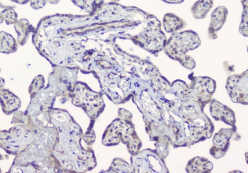 IHC staining of FFPE human placental tissue with ALIX antibody. HIER: boil tissue sections in pH6 citrate buffer for 20 min and allow to cool before testing.
