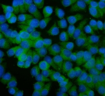 Immunofluorescent staining of FFPE human T-47D cells with ALIX antibody (green) and DAPI nuclear stain (blue). HIER: steam section in pH6 citrate buffer for 20 min.