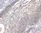 IHC staining of FFPE human esophagus squama tissue with ALIX antibody. HIER: boil tissue sections in pH6 citrate buffer for 20 min and allow to cool before testing.