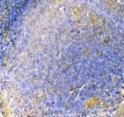 IHC staining of FFPE mouse intestine tissue with ALIX antibody. HIER: boil tissue sections in pH6 citrate buffer for 20 min and allow to cool before testing.