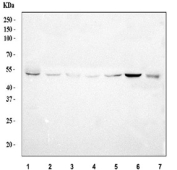 Western blot testing of 1) human placenta, 2) human HeLa, 3) human U-87 MG, 4) human 293T, 5) rat stomach, 6) rat pancreas and 7) mouse pancreas tissue lysate with UBE2Q2 antibody. Predicted molecular weight ~43 kDa, routinely observed at 43-46 kDa.
