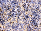 IHC testing of FFPE mouse spleen with TRIB2 antibody. HIER: Boil the paraffin sections in pH 6, 10mM citrate buffer for 20 minutes and allow to cool prior to staining.