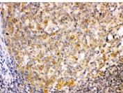 IHC testing of FFPE human tonsil with TRIB2 antibody. HIER: Boil the paraffin sections in pH 6, 10mM citrate buffer for 20 minutes and allow to cool prior to staining.