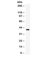 Western blot testing of human SW620 cell lysate with TRIB2 antibody. Expected/observed molecular weight ~39 kDa.
