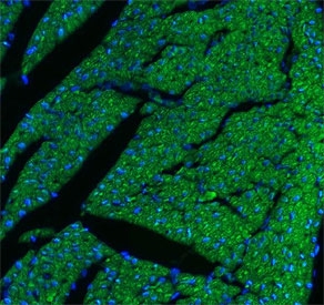 Immunofluorescent staining of FFPE rat heart tissue with CPT1B antibody (green) and DAPI nuclear stain (blue). HIER: steam section in pH8 EDTA buffer for 20 min.
